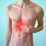 ריפלוקס, בקע סרעפתי